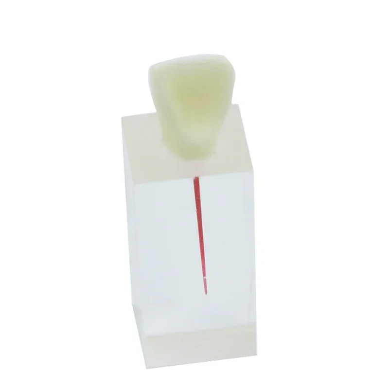 

Dental Model Endodontic Root Canal Block Practice Teeth Pulp Cavity Resin Study Endo Training Student Teaching