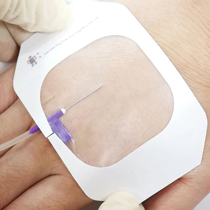 1/5Pcs Medical Waterproof Wound Dressing PU Film Breathable Sterile Cannula Infusion Indwelling Needle Fixation Sticker