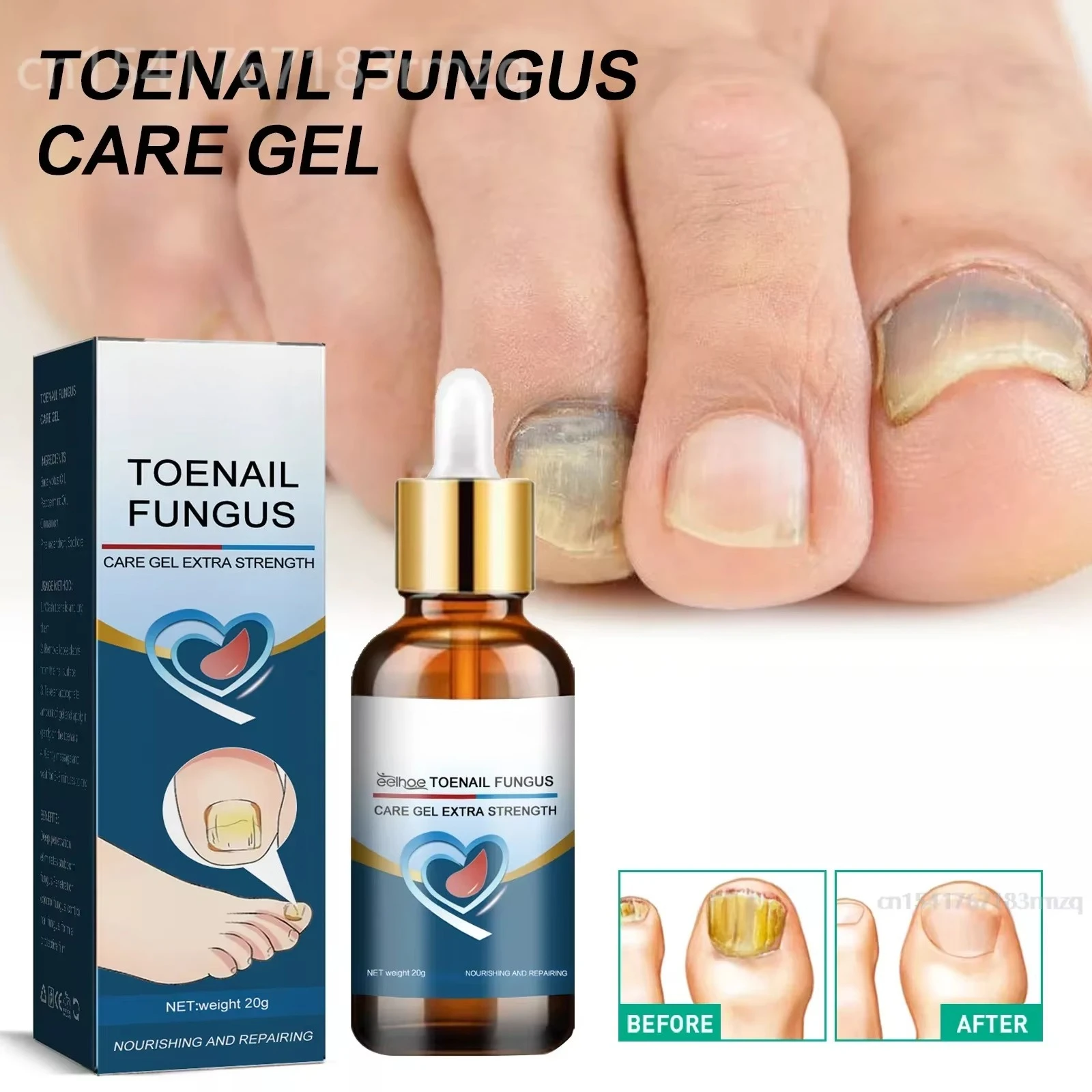 

uñas Toenail Repair 20g Nail Repair for Damaged Nails for Toenail or Fingernail Safe Nail Solution for Discolored Damaged Nails
