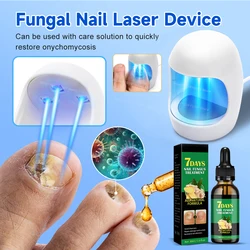 Dispositivo laser para unhas fúngicas, reparação rápida de fungos de onicomicose, unhas para pés, fungos, óleo essencial, tratamento de unhas