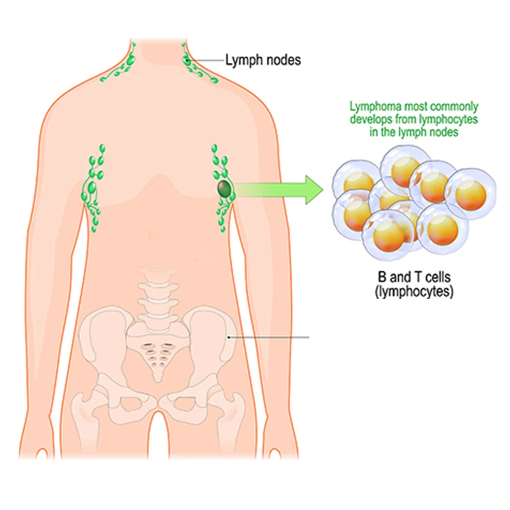 Рисунок 6 - 8/40/80 шт Sumifun лимфатический
