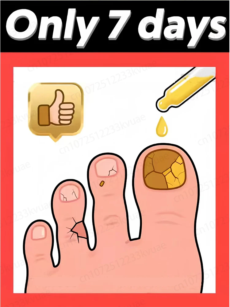 

Quickly eliminates fungus and restores healthy nails