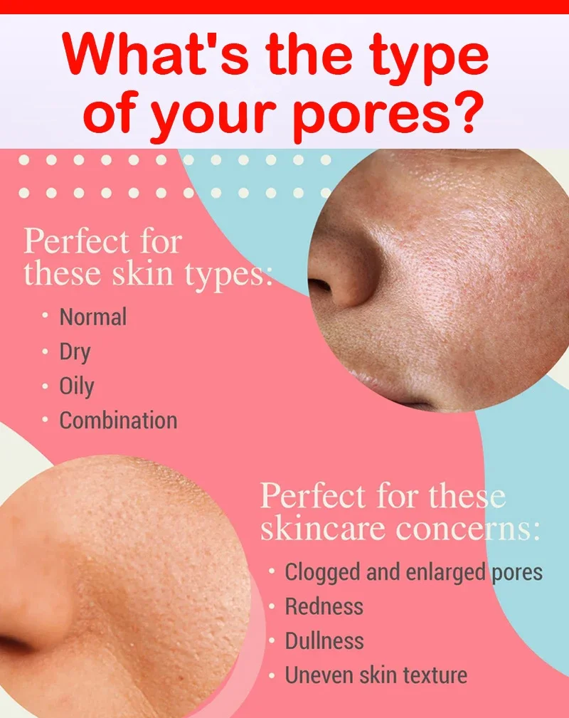 Soro De Encolhimento De Poros, Removedor De Poros, Encolher Aperto, Minimizando, Poros Intensivos, Produtos De Cuidado Da Pele, Tratamento De Acne