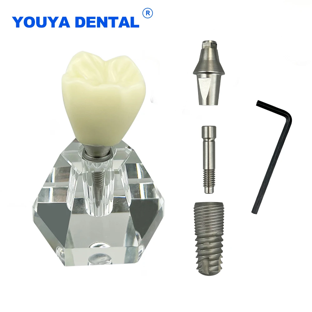 

Dental Crystal Implant Model Teeth Communication Transparent Dental Practice Removable Dentures Analysis Study Clear Dentistry