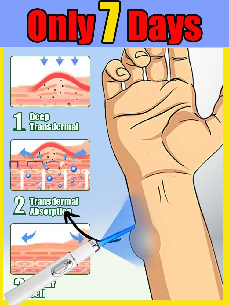 

Многофункциональная лазерная ручка с синим светом решает проблемы кожи на теле, больше беспокойство об проблемах кожи.