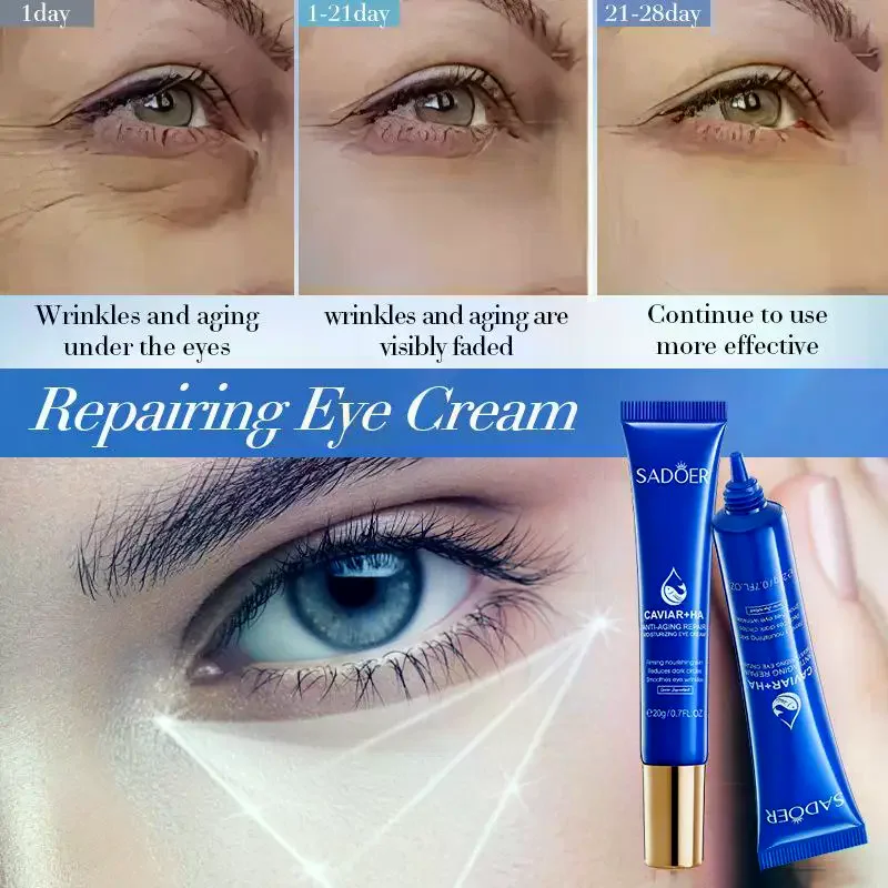 20g SADOER Caviar Hyaluronic Acid Eye Cream Anti Dark Circles Removal Eyes Bags Anti-aging Moisturizing Eyes Skin Care - view 2