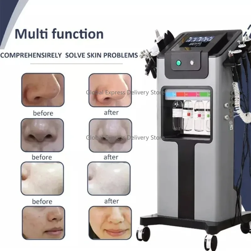 Facial Cleansing Dermabrasion Machine  Peel Cleaning Water  Facial Machine