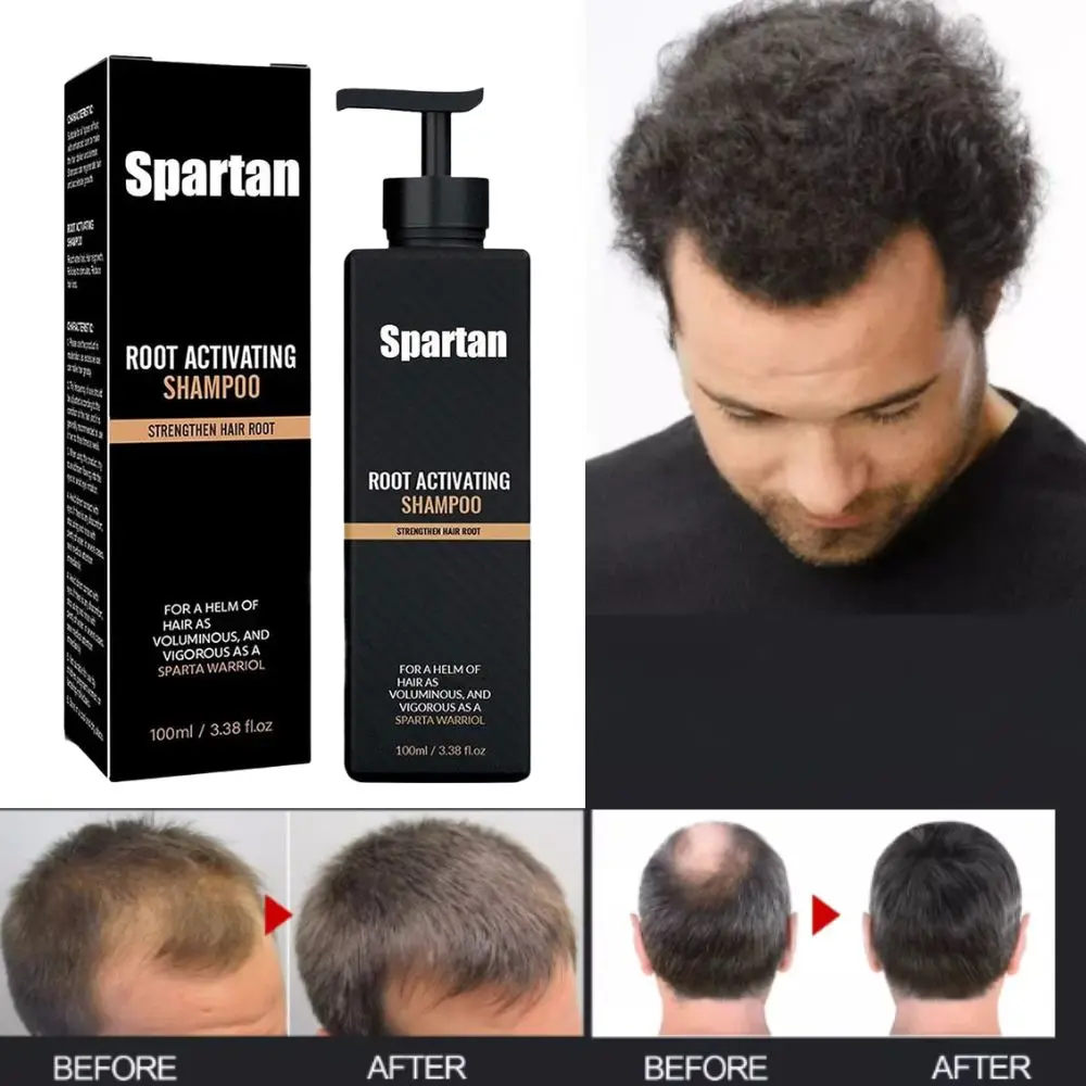 

Spartan Root Activator Hair Regrowth Shampoo Anti Hair Loss Oil Control Fluffy Relieve Itching Scalp Care Hair Conditioner