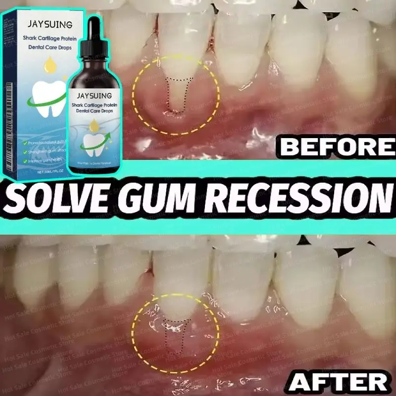 Rapid Repair Gums Serum Effectively Relieve Tooth Allergy Dental Caries Tooth Cleaning Toothpaste Relieve Tooth Damage Drops