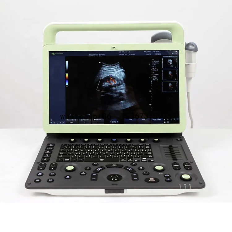 3D 4D Best Quality Color Doppler Cardiac- Ultrasound Machine Price