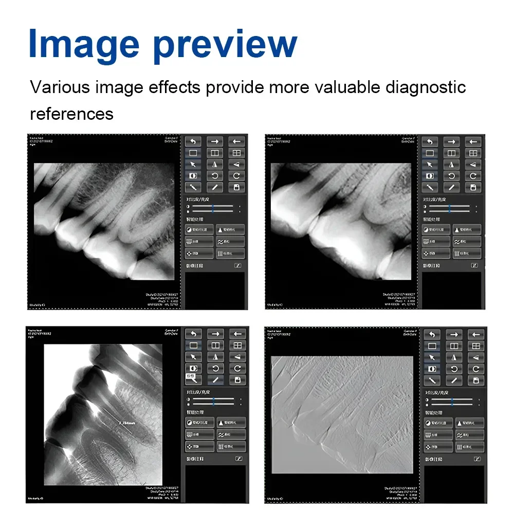 Portable dental xray sensor digital x-ray Sensor Dental Intraoral Digital  X Ray Sensor High Resolution Ultra-slim Equipment