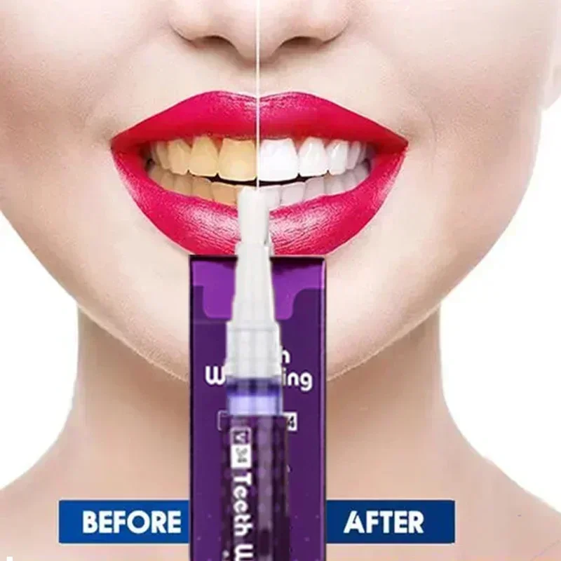 Teeth Whitening Gel Pen Remove Yellow Tooth Smoke Plaque Stains Cleaning Brighten Dazzling White Oral Hygiene Dental Teeth Care