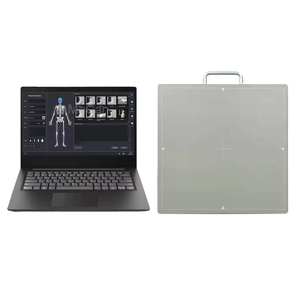 Portable Digital Flat Panel X-Ray Detector Durable Medical Equipment for Hospital or Clinic Use with Laptop Metal Material