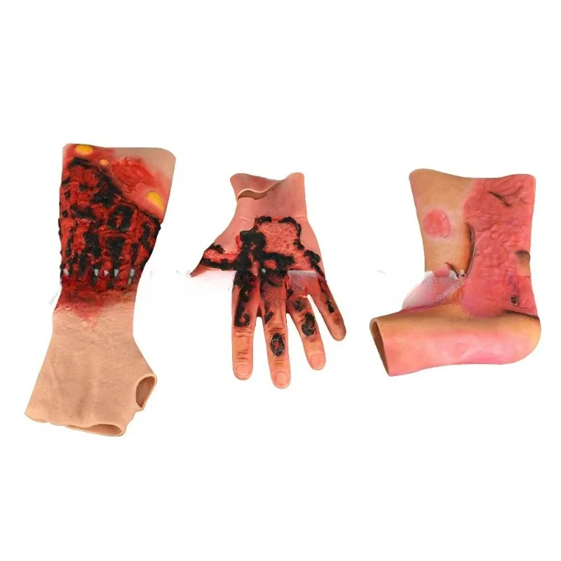 3rd Degree Forearm Burn Simulation Sleeve Simulated Burn Wound Dressing Trainer Medical Wound Care Teaching Model