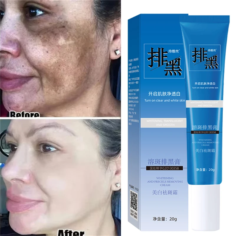 

Dark Spots Removal Cream Facial Whitening Freckle Acne Mark Pigmentation Removal Melanin Skin Correction Brighten Care Products