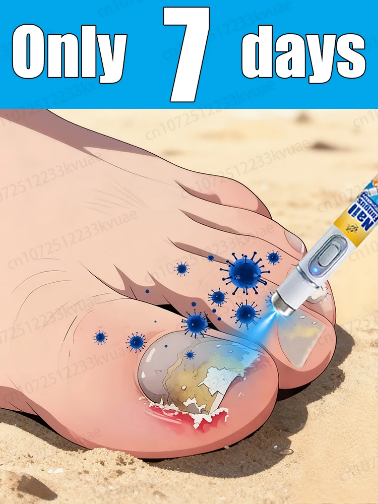 

Say goodbye to onychomycosis, no recurrence, no damage to nails.