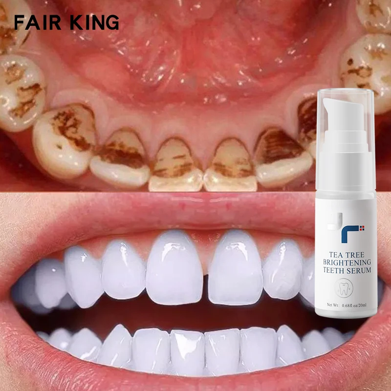 

FAIR KING Teeth Whitening Liquid Bright Refreshing Fresh Breath Hygiene Cleaning Care Plant Formula Removes Plaque Smoke Stains