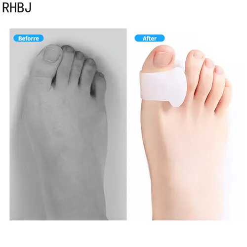 Imagen 2 del producto Nuevo 4 Uds cuidado de los pies de silicona pedicura juanete ajustador pies dedos Protector hueso Hallux Valgus Corrector Gel separador del dedo gordo