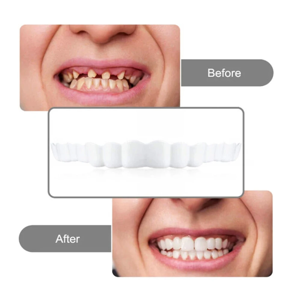 Teeth Veneers Whitening Dentures Braces Temporary False Teeth Cover Perfect Smile Comfortable Fit Denture Kit