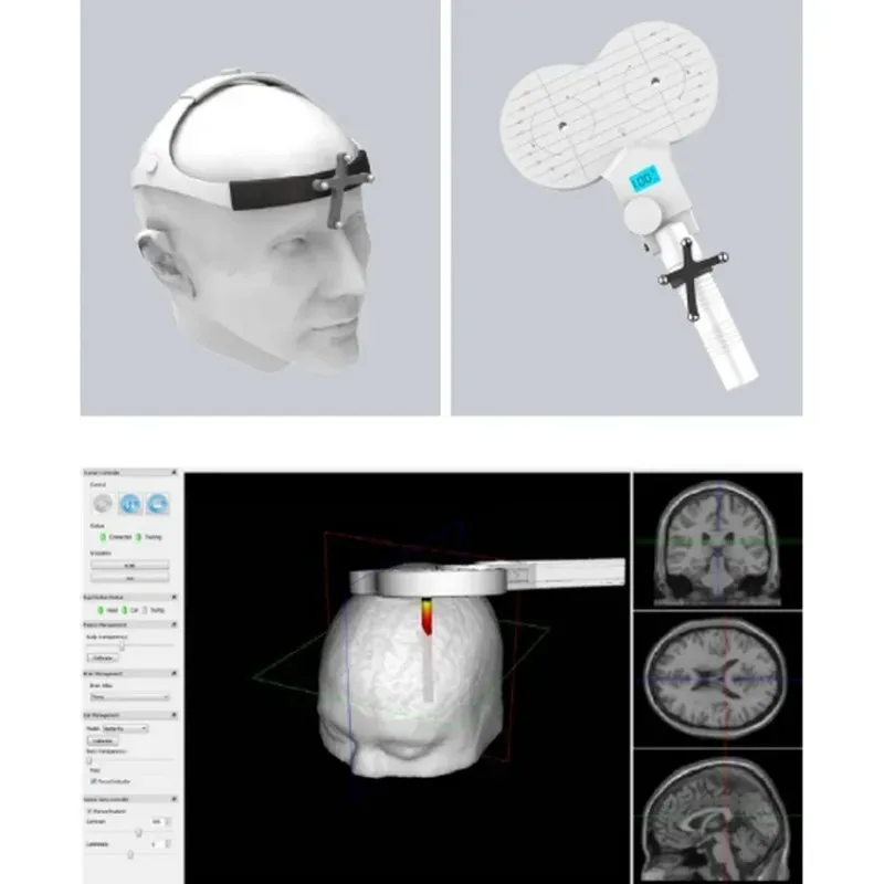 Strumento di stimolazione magnetica a impulsi magnetici transcranici 1.5T TMS rTMS iTBS DTMS sistema di raffreddamento multifunzionale