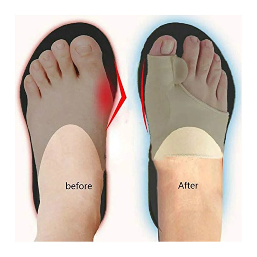 Hallux valgus مصحح ، 2 أجزاء ، تقويم العظام ، العظام ، الإبهام الضابط ، باديكير ، جورب ، مستقيم