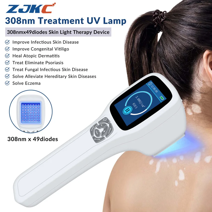 

ZJKC 308nm Excimer System Uv B Light Vitiligo Spot Treatment Ultraviolet Blue Lamp Therapy Device for Psoriasis Eczema