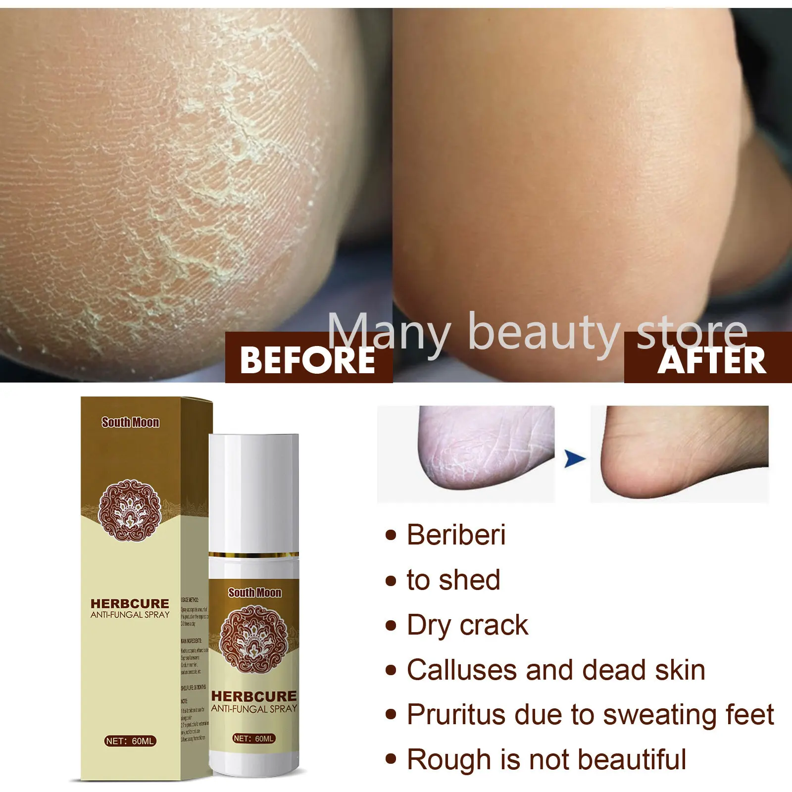 Herbal Foot Spray 60ml Foot Odor Foot Sweat Care Spray Foot Dehumidifying Spray Foot Skin Care Product