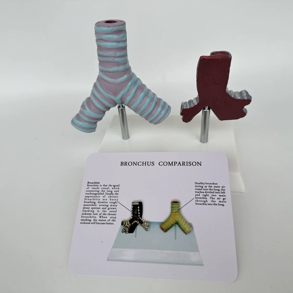 

Comparative model of human healthy trachea and smoking trachea
