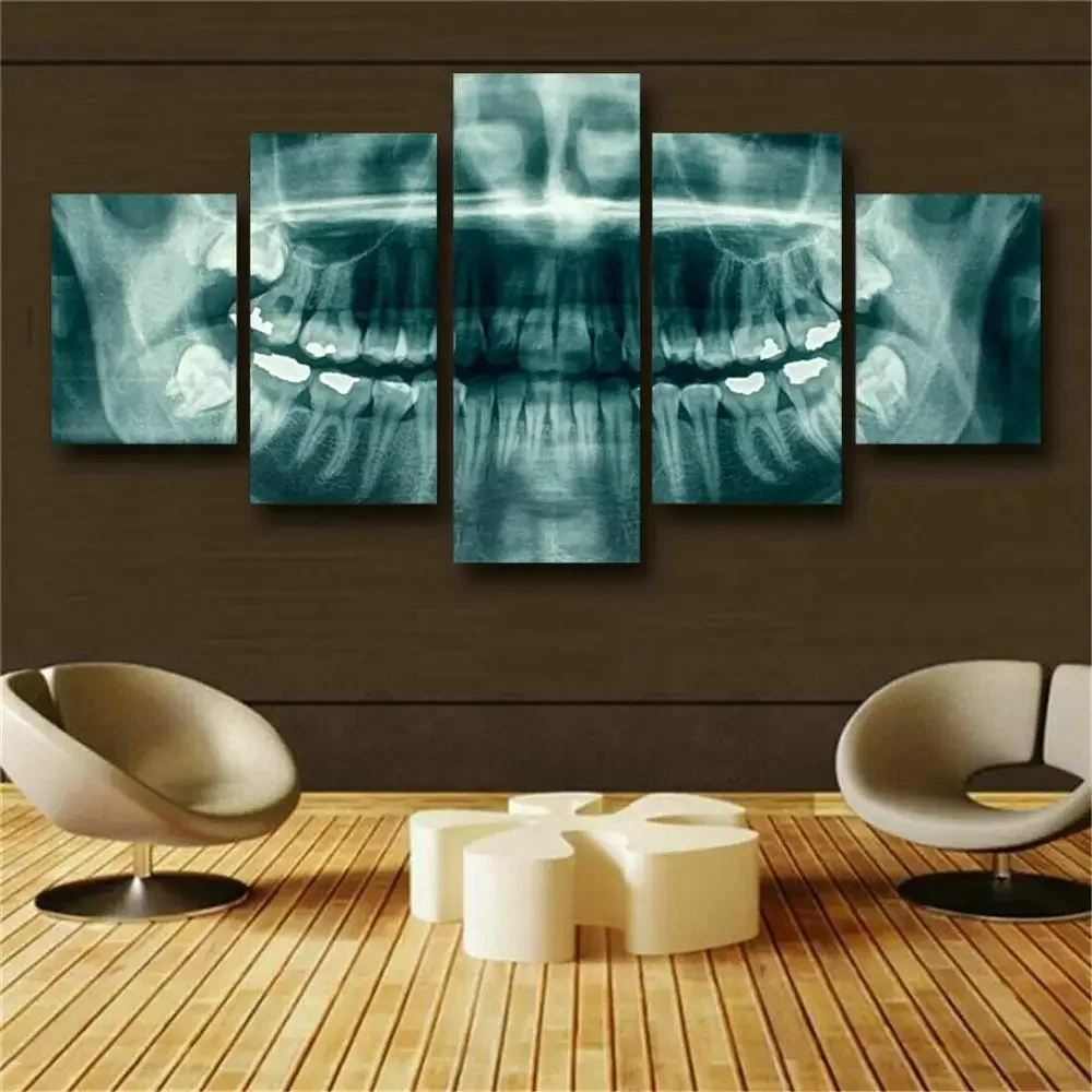 Wall Art Pictures Home Decor Modern HD Prints Canvas 5 Panel Dental Teeth X-Ray Dentist Painting Health Medicine Poster No Frame