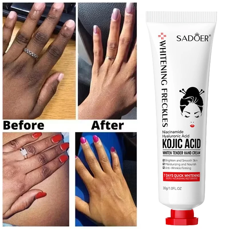 Ácido kójico branqueamento creme para as mãos, Fade Dull, juntas escuras, Anti-rugas, Anti-Crack, Secagem Fade Fine Lines, Ilumine Smooth Skin Care