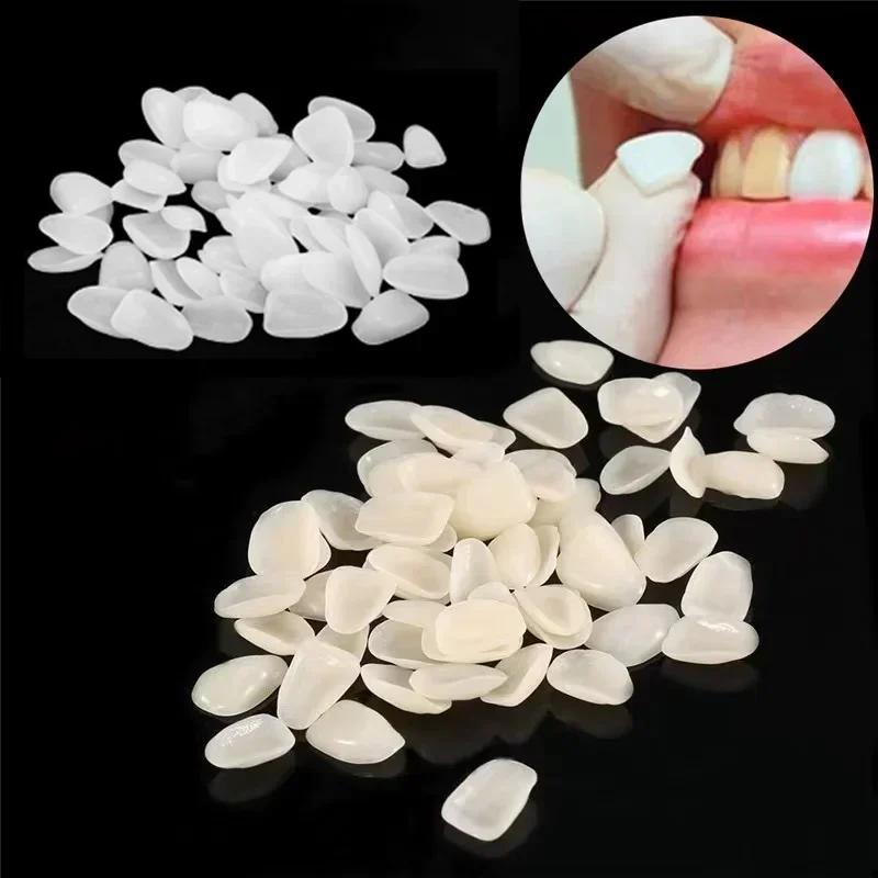 50 PCS Teeth Veneers Resin Temporary Crown Ultra Thin Repair Whitening  Sets Dentist False Tooth Oral Care Cleaning Materials