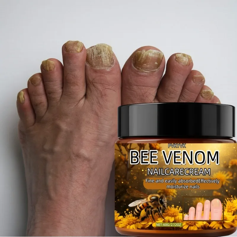 ครีมทาเล็บอันทรงพลัง เหมาะสำหรับการดูแลเล็บที่แห้ง หยาบกร้าน เปราะบาง ช่วยให้เล็บแข็งแรง ลดการเหลือง ซึมซาบเร็ว บำรุงให้ความชุ่มชื้น และเรียบเนียน