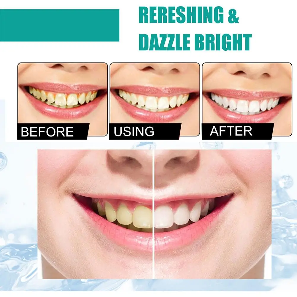 5 dias dentes branqueamento em pó remover manchas de placa creme dental limpeza ferramentas profundas higiene dentes fresco cuidados orais respiração dententa o8d0