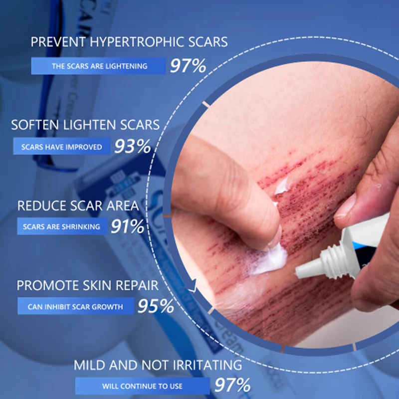 Herbal Scar Removal Cream Treatment Burn Surgical Scar Stretch Marks Acne Spots Repair Pigmentation Body Smooth Beauty Skin Care