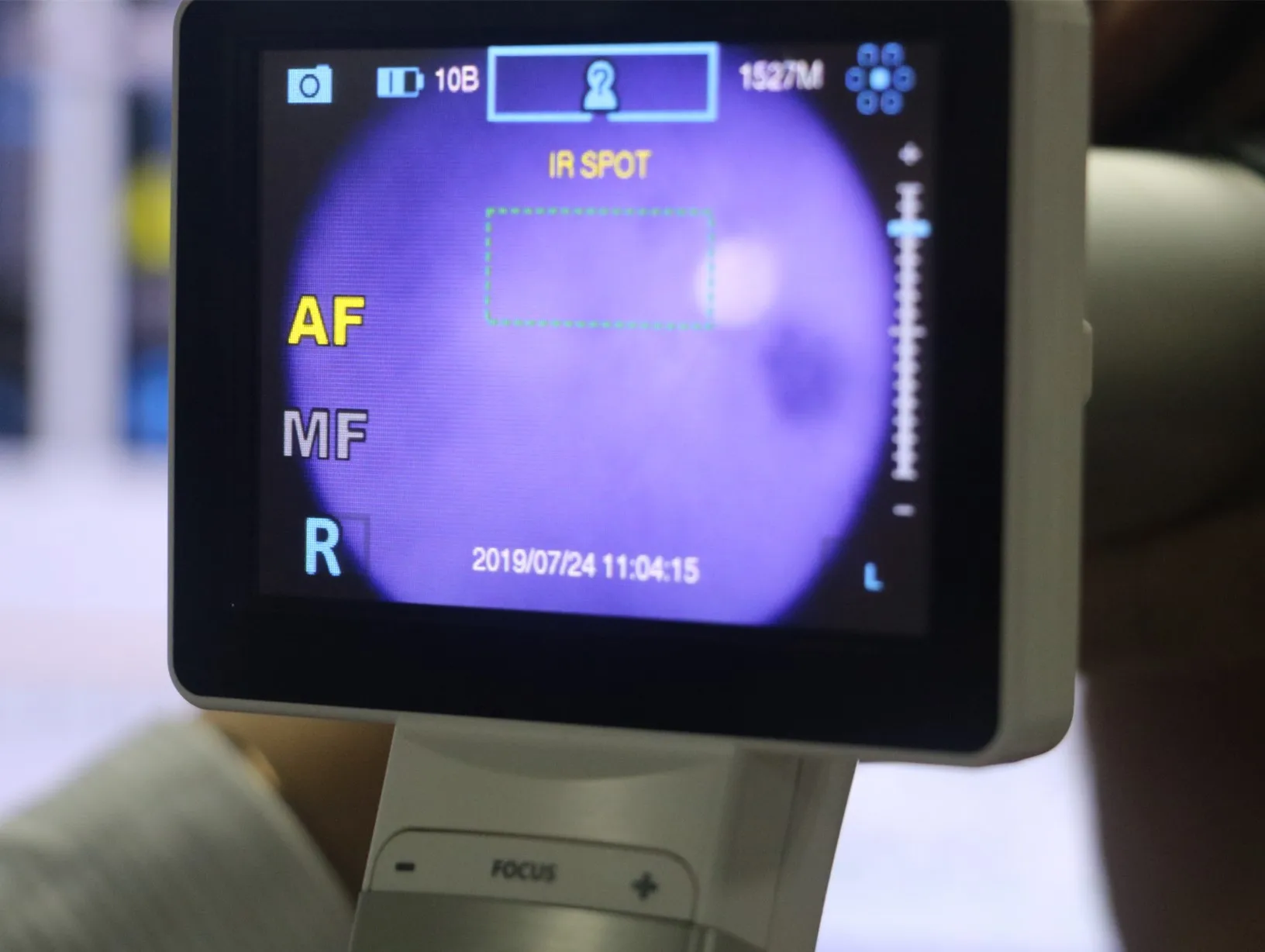 MiiS Fundus Camera Horus Caméra Fundus portable Caméra réinale
