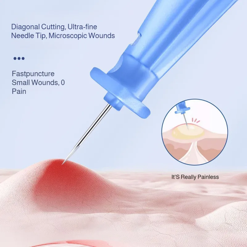 Jednorazowe specjalne igły do usuwania zaskórników, igły do usuwania zaskórników z zamkniętymi ustami, igły do usuwania zaskórników z granulkami tłuszczowymi, ultracienkie igły do usuwania zaskórników dla kobiet i mężczyzn.