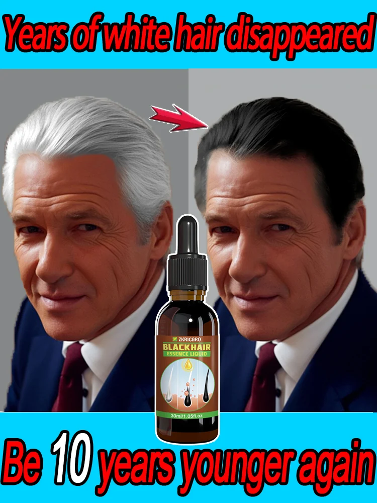 Get black hair quickly, treat gray hair, healthy and safe.