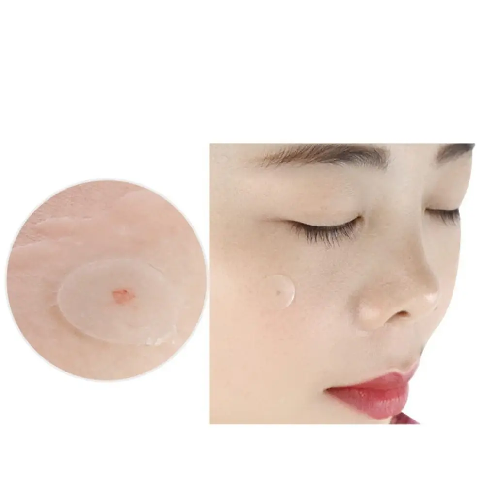 الجلد الاصطناعي حب الشباب إزالة التصحيح غير مرئية شفافة بثرة التصحيح المخفي امتصاص السائل حب الشباب التطهير التصحيح الرجال النساء