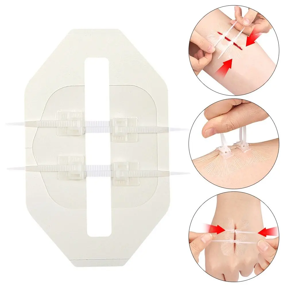 Adhesive Wound Care Zip Sutures Bandaids First Aid Emergency Zipper Laceration Repair Without Stitches Laceration Repair