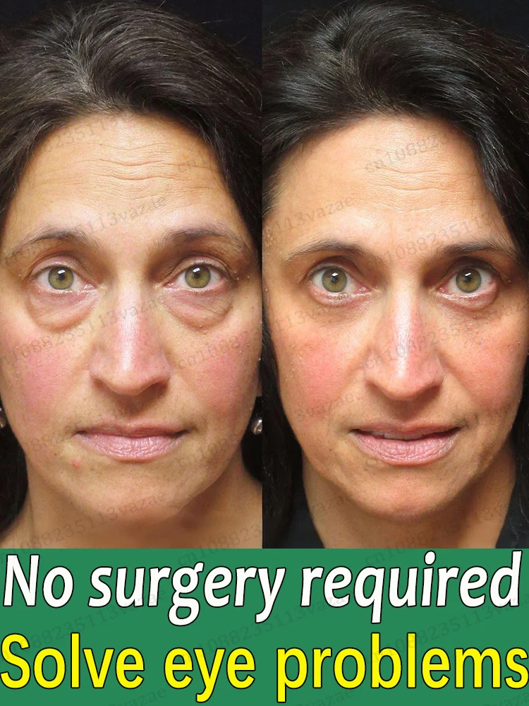 2025 Najlepiej sprzedające się produkty, które sprawią, że optycznie optycznie o 20 lat młodszy