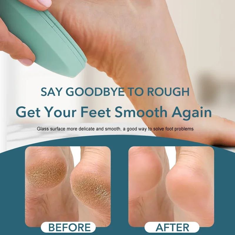Lima de placa de pie de nanovidrio, borrador de pelo de cristal para pedicura, depilación física, depiladora segura indolora, herramienta reutilizable para el cuidado de los pies, 1 ud.