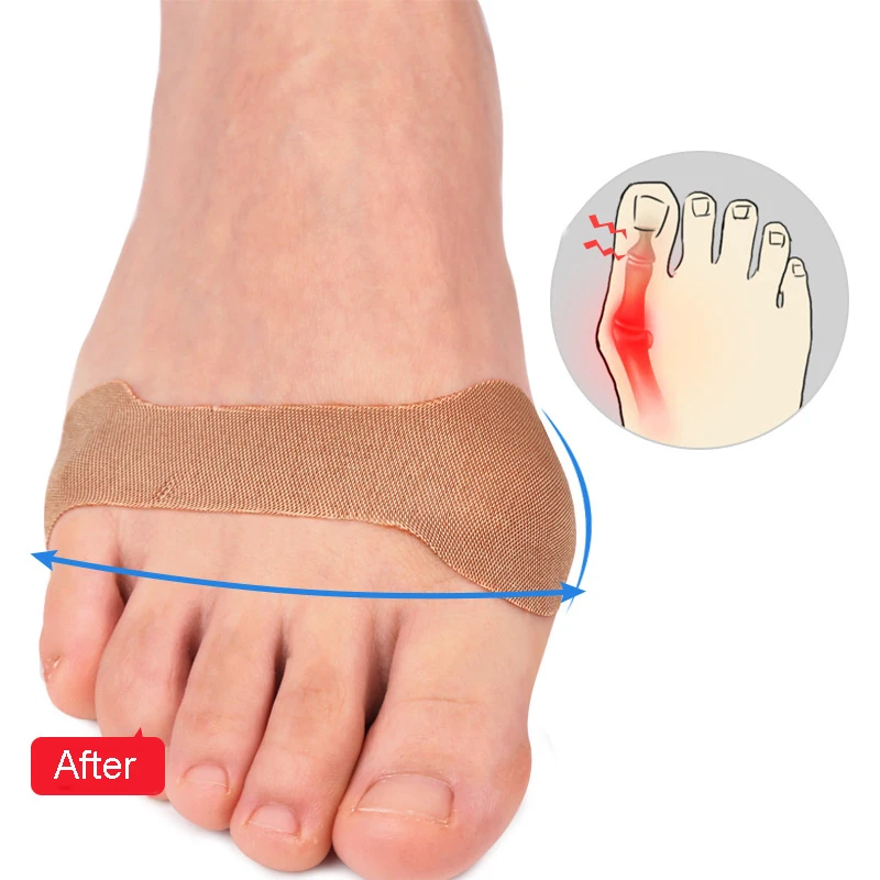 5 Stück Hallux Valgus ortho pä disches Pflaster Big Toe Separator Anti-Verschleiß-Fuß aufkleber Sports chutz gelenk fester Finger selbst klebend