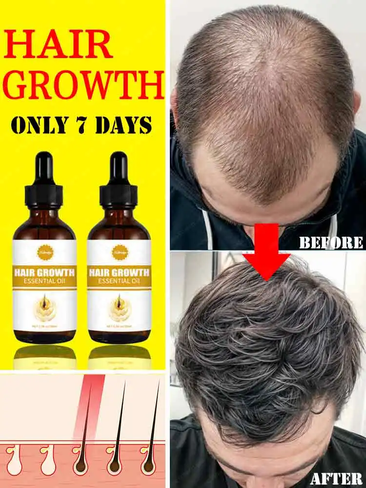 

Hair regeneration oil repairs hair follicles on the head, increases hair volume, and prevents hair loss