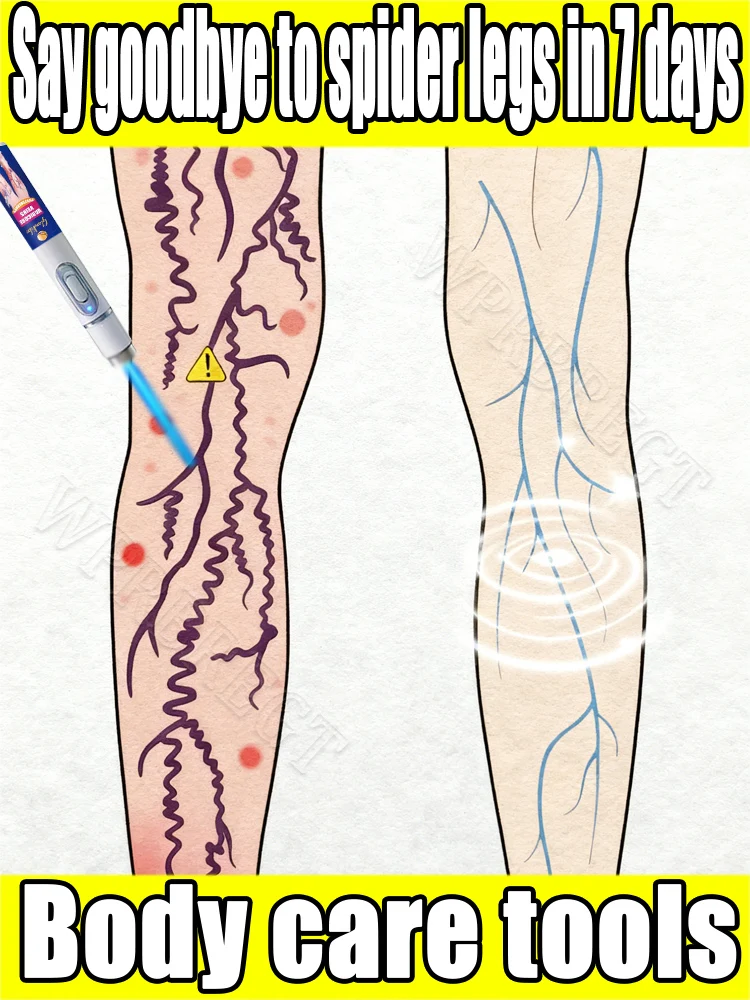 

Blue ʟɪɢʜᴛ ᴘᴇɴ, ᴀ ʙᴇsᴛsᴇʟʟᴇʀ ɪɴ 95% ᴏғ ᴛʜᴇ ᴡᴏʀʟᴅ: restores ʟᴇɢ health.