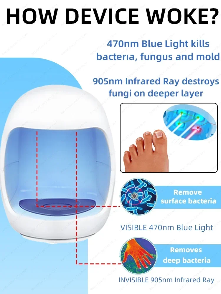 Potente attrezzatura laser può non solo riparare l'onicomicosi, ma anche curare l'armatura del cuore.