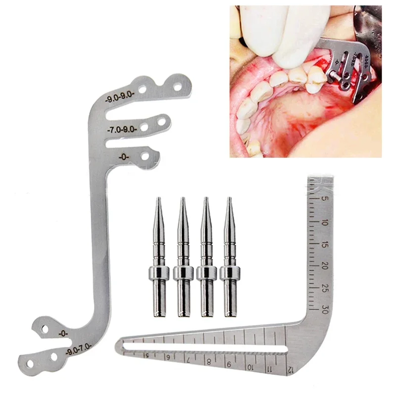

Dentist Implant Tools Drilling Positioning Ruler Angle Ruler Dental Implant Guide Set Oral Planting Locator Positioning Guide