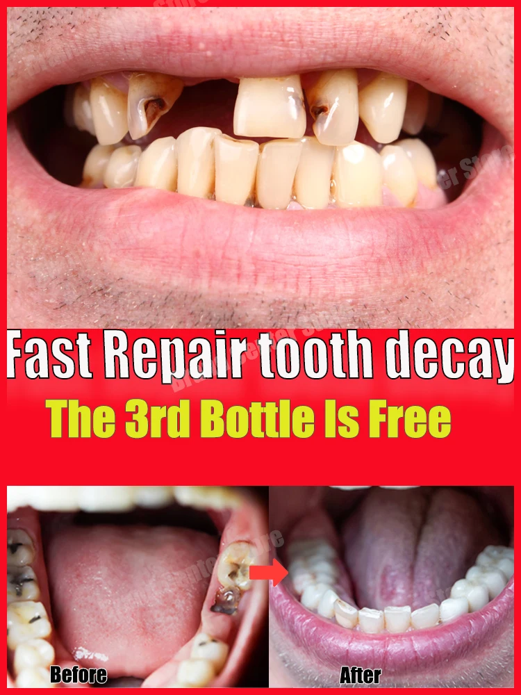 repair a dental cavity