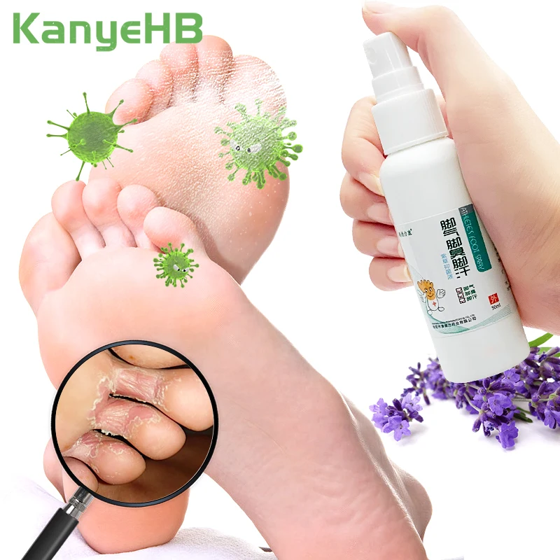 

1pc Anti Fungal Beriberi Foot Spray Remove Foot Odor Beriberi Itching Foot Care Chinese Herbal Medicine Foot Ointment S062