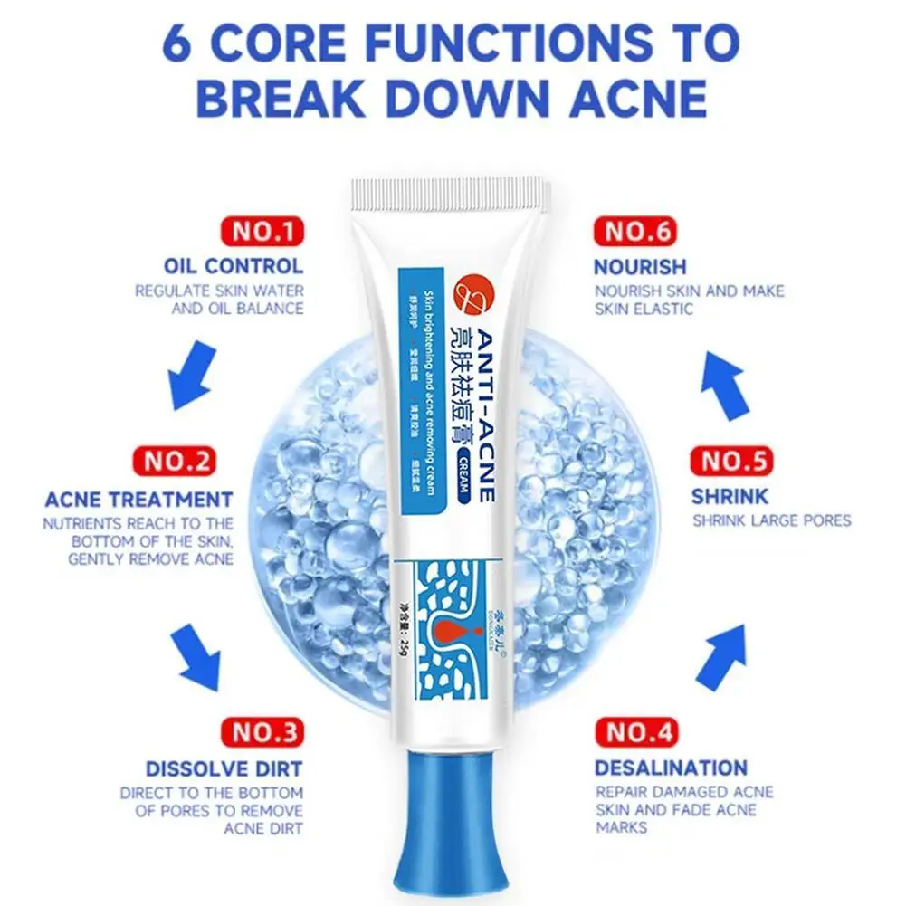 にきび治療クリーム,にきび防止,効果的,にきび防止,収縮製品,ケアスポット,滑らかな毛穴,保湿,輝き,p9h1