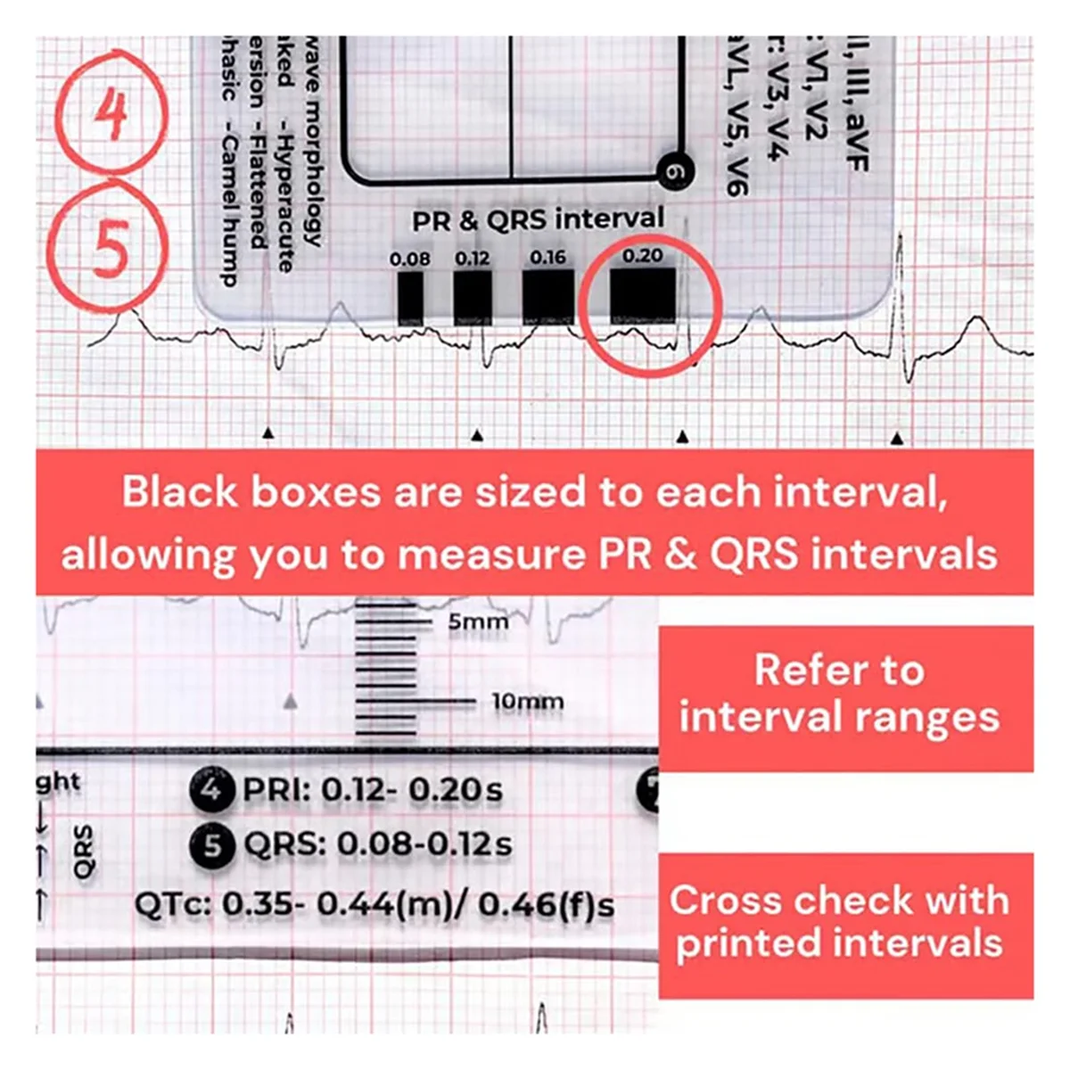 AT77 2PCS ECG 7 Step Ruler, ECG 7 Step Ruler for ECG/EKG Interpretation, ECG Ruler, Portable ECG Assessment Tool EKG Card